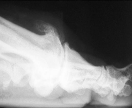 arthritis-before-image-1